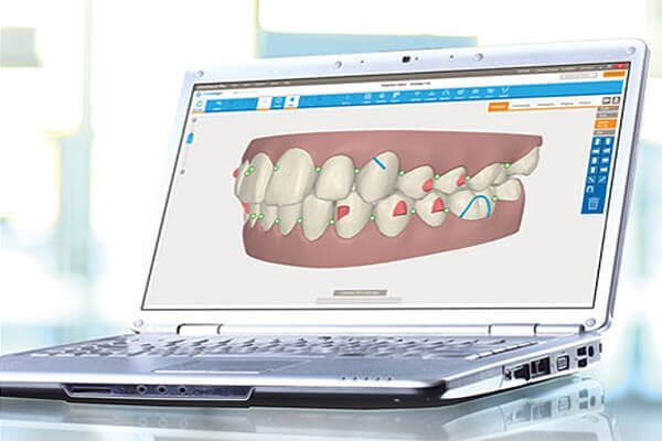 E-CONFERENCE INVISALIGN - Cursos Ortodoncia Invisible Cristina Viyuela