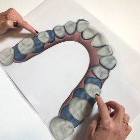 CURSO CERTIFICACIÓN INVISALIGN – CRISTINA VIYUELA