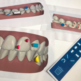 CURSO CERTIFICACIÓN INVISALIGN – CRISTINA VIYUELA